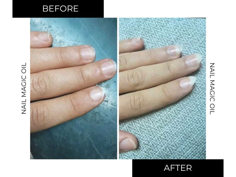 Double nail oil offer - Image 6