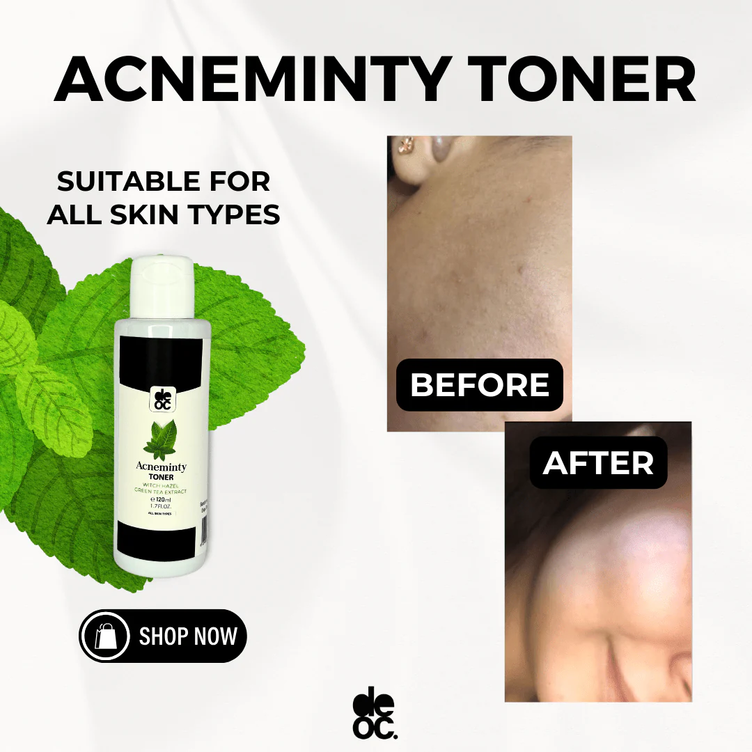 Acneminty toner (120mL) - Image 3