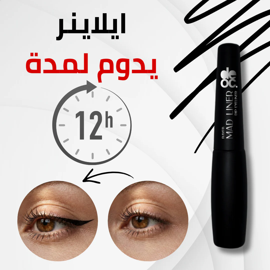 Cat Eye Kit - Image 5